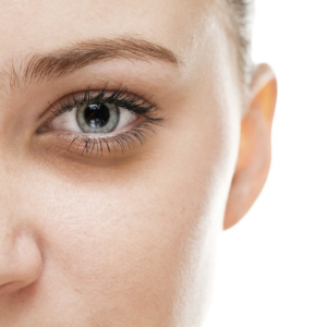 Dark Circles Treatment
